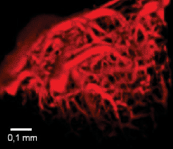 Image: Cerebral vascular system of a mouse obtained by 3D two-photon microscopy with addition of Lem-PHEA (Photo courtesy of B. van der Sanden and F. Appaix, Institut des Neurosciences de Grenoble). Image: Cerebral vascular system of a mouse obtained by 3D two-photon microscopy with addition of Lem-PHEA (Photo courtesy of B. van der Sanden and F. Appaix, Institut des Neurosciences de Grenoble).